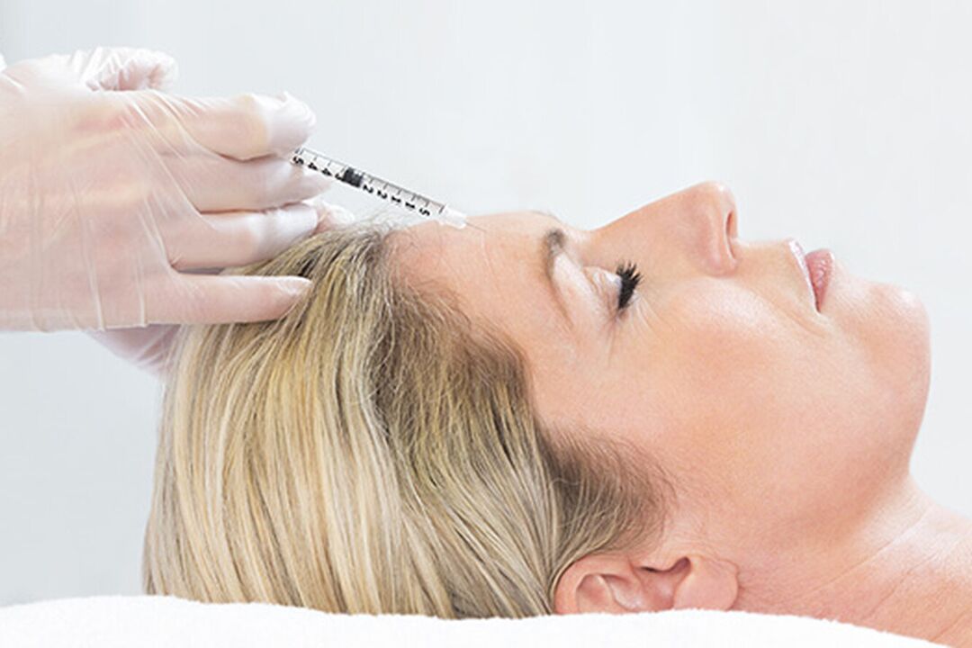 Плазмолифтинг – инъекционный метод омоложения кожи лица. 